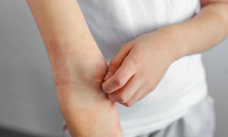 Person juckt eine Stelle am Ellenbogen